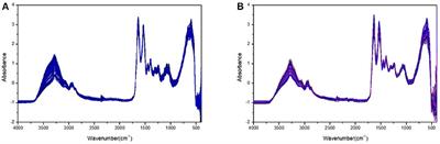 A Plasma Biochemical Analysis of Acute Lead Poisoning in a Rat Model by Chemometrics-Based Fourier Transform Infrared Spectroscopy: An Exploratory Study